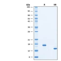 R D Systems Recombinant Human Flt-3 Ligand/FLT3L (E. coli) Protein 100 &mu;g | Buy Online | R&amp;D Systems&trade; | Fisher Scientific