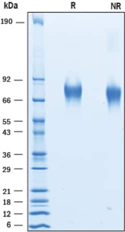 R&D Systems&trade;&nbsp;Recombinant Human Guanylyl Cyclase C His-tag Protein