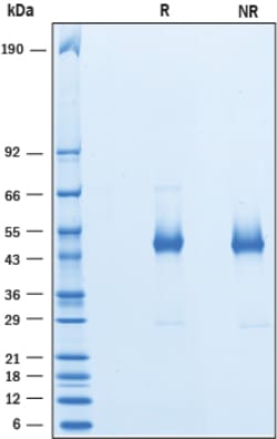 R&D Systems™ Recombinant Human HSP47 His-tag Protein