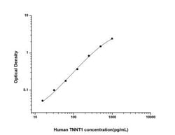 Novus Biologicals™ Human Troponin T type 1 (slow skeletal) ELISA Kit (Colorimetric)