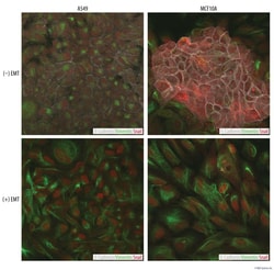 R&D Systems™ Human EMT 3-Color Immunocytochemistry Kit