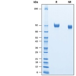 R D Systems Recombinant Mouse ICAM-1/CD54 His-tag Protein 50 &mu;g | Buy Online | R&amp;D Systems&trade; | Fisher Scientific