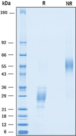 R&D Systems&trade;&nbsp;Recombinant Human ICOS (aa 21-140) His-tag Protein