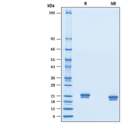 R&D Systems&trade;&nbsp;Recombinant Mouse IFN-alpha 7/IFNA7 Protein