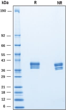 R&D Systems&trade;&nbsp;Recombinant Mouse IGSF4B/SynCAM3 His-tag Protein