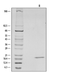R D Systems Recombinant Mouse IL-1 beta/IL-1F2 Protein 100 &mu;g | Buy Online | R&amp;D Systems&trade; | Fisher Scientific