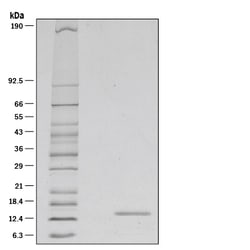 R D Systems Recombinant Mouse IL-21 Protein 100 &mu;g | Buy Online | R&amp;D Systems&trade; | Fisher Scientific