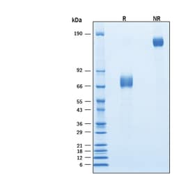 R D Systems Recombinant Cynomolgus IL-10 R alpha Fc Chimera Protein 50 &mu;g | Buy Online | R&amp;D Systems&trade; | Fisher Scientific