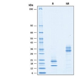 R D Systems Recombinant Cynomolgus Monkey IL-17/IL-17A Protein 50 &mu;g | Buy Online | R&amp;D Systems&trade; | Fisher Scientific