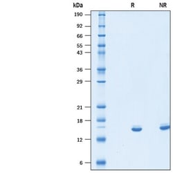 R&D Systems&trade;&nbsp;Recombinant Human IL-2 (Mammalian-expressed) Protein