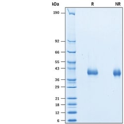 R&D Systems&trade;&nbsp;Recombinant Human IL-2 R beta His-tag Avi-tag Protein
