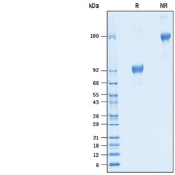 R D Systems Recombinant Cynomolgus/Rhesus IL-6R alpha Fc Protein 50 &mu;g | Buy Online | R&amp;D Systems&trade; | Fisher Scientific