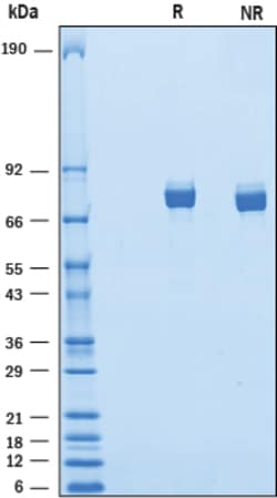 R D Systems Recombinant Mouse IL-Y Protein 50 &mu;g | Buy Online | R&amp;D Systems&trade; | Fisher Scientific
