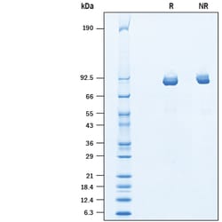 R&D Systems&trade;&nbsp;Recombinant Human ITIH3 His-tag Protein