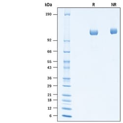 R&D Systems&trade;&nbsp;Recombinant Human ITIH4 His-tag Protein