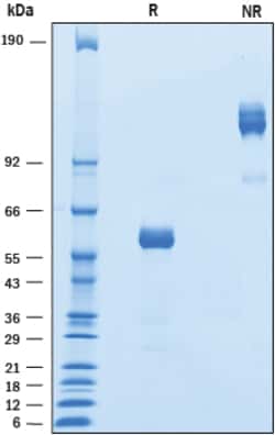 R D Systems Recombinant Mouse LAIR1 Fc Chimera Protein 50 &mu;g | Buy Online | R&amp;D Systems&trade; | Fisher Scientific
