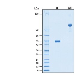 R D Systems Recombinant Human LAIR2 Fc Chimera Protein 50 μg | Buy Online | R&D Systems™ | Fisher Scientific