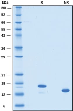 R D Systems Recombinant Human LECT2 Protein 50 &mu;g | Buy Online | R&amp;D Systems&trade; | Fisher Scientific