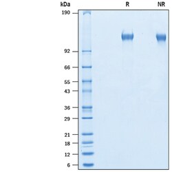 R&D Systems&trade;&nbsp;Recombinant Mouse LRRN4 His-tag Protein