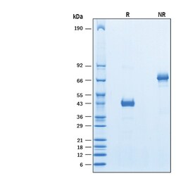 R D Systems Recombinant Human Ly6D Fc Chimera Protein 50 &mu;g | Buy Online | R&amp;D Systems&trade; | Fisher Scientific