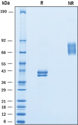 R&D Systems&trade;&nbsp;Recombinant Human Ly6E Fc Chimera Protein