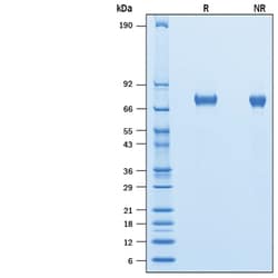 R&D Systems&trade;&nbsp;Recombinant Human Lymphotoxin alpha1/beta2 Avi Protein