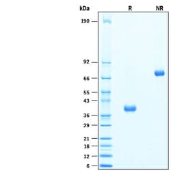 R D Systems Recombinant Human MFAP4 Protein 50 &mu;g | Buy Online | R&amp;D Systems&trade; | Fisher Scientific