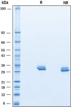 R&D Systems&trade;&nbsp;Recombinant Human Myocilin His-tag Protein, CF