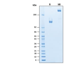R D Systems Recombinant Human NCAM-1/CD56 Fc Chimera Protein 50 &mu;g | Buy Online | R&amp;D Systems&trade; | Fisher Scientific