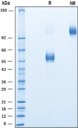 R&D Systems&trade;&nbsp;Recombinant Human NKG2C/CD159c Fc Chimera Protein