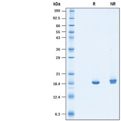 R&D Systems&trade;&nbsp;Recombinant Human NM23-H2 His-tag Protein