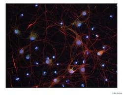 R D Systems NeuroXVivo Rat Motor Neuron Culture Kit 1 Kit | Buy Online | R&amp;D Systems&trade; | Fisher Scientific