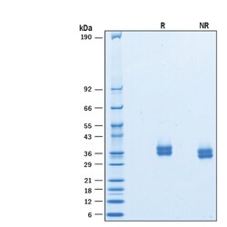 R D Systems Recombinant Cynomolgus Monkey PD-L1/B7-H1 His Protein 100 &mu;g | Buy Online | R&amp;D Systems&trade; | Fisher Scientific