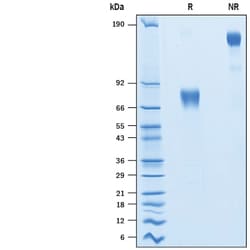 R D Systems Recombinant Porcine PD-L1/B7-H1 Fc Chimera Protein 100 &mu;g | Buy Online | R&amp;D Systems&trade; | Fisher Scientific