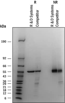 R&D Systems&trade;&nbsp;Recombinant Human PHGDH His-tag