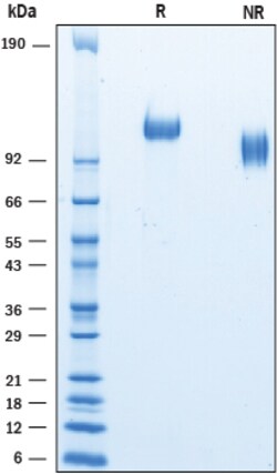 R&D Systems&trade;&nbsp;Recombinant Mouse P-Selectin/CD62P His-tag Protein