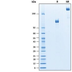 R D Systems Recombinant Mouse PTK7/CCK4 Fc Chimera Protein 50 &mu;g | Buy Online | R&amp;D Systems&trade; | Fisher Scientific
