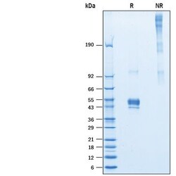 R D Systems Recombinant Human Pentraxin 3/TSG-14 His-tag Protein 50 &mu;g | Buy Online | R&amp;D Systems&trade; | Fisher Scientific