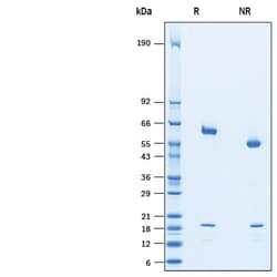 R&D Systems&trade;&nbsp;Recombinant Cynomolgus Monkey PCSK9 His-tag Protein