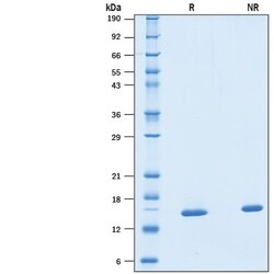 R D Systems Recombinant Human SF20/MYDGF Protein 50 &mu;g | Buy Online | R&amp;D Systems&trade; | Fisher Scientific
