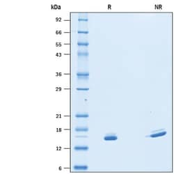 R D Systems Recombinant Mouse SF20/MYDGF Protein 50 &mu;g | Buy Online | R&amp;D Systems&trade; | Fisher Scientific