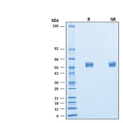 R D Systems Recombinant Cynomolgus SIRP beta 1/CD172b His Protein 50 &mu;g | Buy Online | R&amp;D Systems&trade; | Fisher Scientific