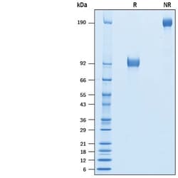 R D Systems Recombinant Cynomolgus SIRP beta 1/CD172b Fc Protein 50 &mu;g | Buy Online | R&amp;D Systems&trade; | Fisher Scientific