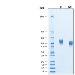 R D Systems Recombinant Human SIRP beta 1/CD172b Protein 50 &mu;g | Buy Online | R&amp;D Systems&trade; | Fisher Scientific