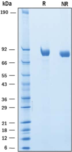 R&D Systems&trade;&nbsp;Recombinant Mouse SLITRK6 Protein