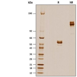 R D Systems Recombinant Mouse Skint2/B7S3 Fc Chimera Protein 50 &mu;g | Buy Online | R&amp;D Systems&trade; | Fisher Scientific