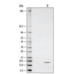 R&D Systems&trade;&nbsp;Recombinant Human TNF-alpha GMP Protein, CF