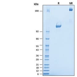 R D Systems Recombinant Mouse TrkA Fc Chimera Protein 50 &mu;g | Buy Online | R&amp;D Systems&trade; | Fisher Scientific