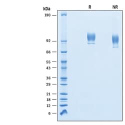 R&D Systems&trade;&nbsp;Recombinant Human VCAM-1/CD106 His-tag Protein