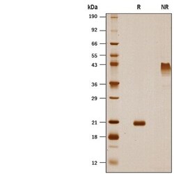 R D Systems Recombinant Human VEGF-B 167 Protein 25 ug | Buy Online | R&amp;D Systems&trade; | Fisher Scientific